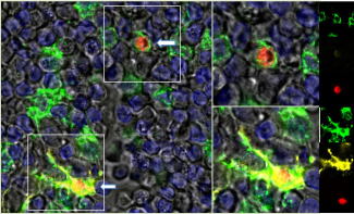 受感染的單核巨噬細胞（以綠色標示）在進入淋巴結及分化為樹突狀細胞（以黃色標示）後SARS冠狀病毒（以紅色標示）的複製過程。